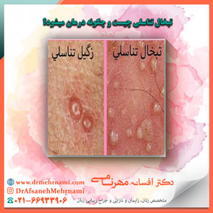 تبخال تناسلی چیست و چگونه درمان میشود؟