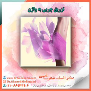 تزریق چربی به واژن
