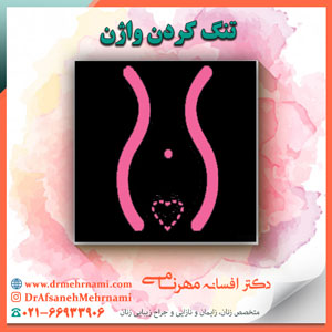 تنگ کردن واژن