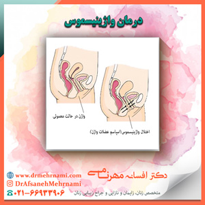 درمان واژینیسموس