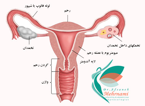 دستگاه-ناحیه-تناسلی-داخلی