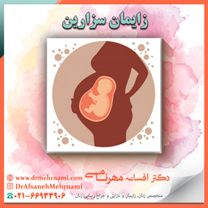 زایمان سزارین