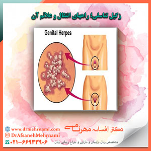 زگیل تناسلی؛ راههای انتقال و علائم آن