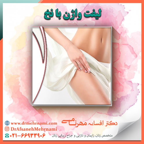 لیفت واژن با نخ