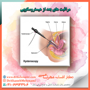 مراقبت های بعد از هیستروسکوپی
