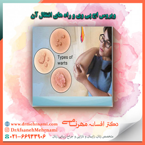 ویروس اچ پی وی و راه های انتقال آن